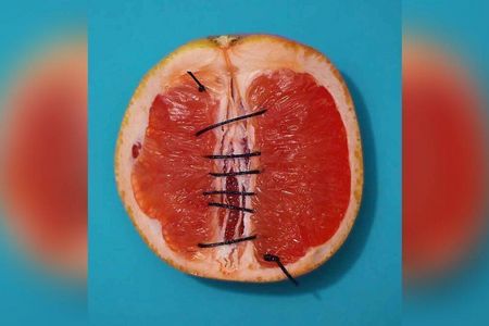PR-Bild Award Sieger für Deutschland und Platz 1 in der Kategorie Storys & Kampagnen: "#TheOtherVulva - Gemeinsam gegen weibliche Genitalverstümmelung", eingereicht von Plan International