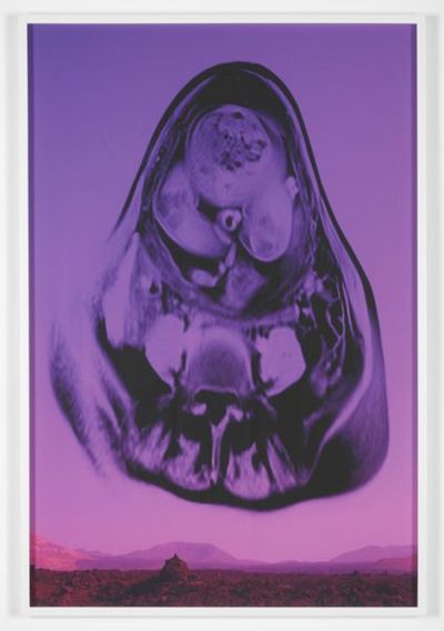 Giclée Druck - ausstellung münchen