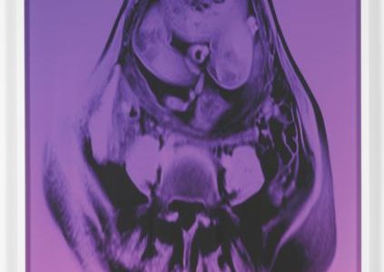 Giclée Druck - ausstellung münchen