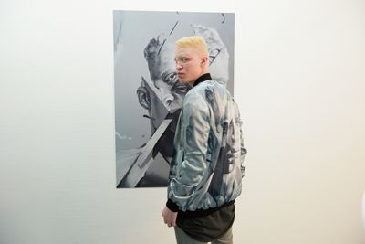 Albino-Model Shaun Ross
