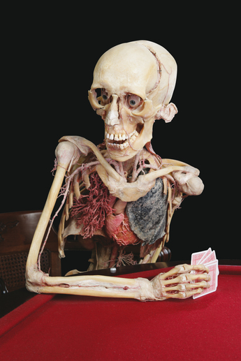 Gunther von Hagens muenchen Gunther von Hagens muenchen