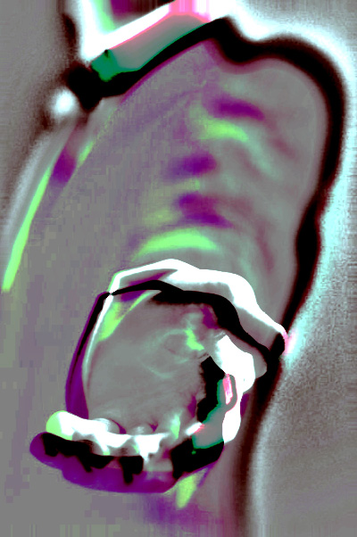 Rainer Magold Kultursommer Rheinlandpfalz